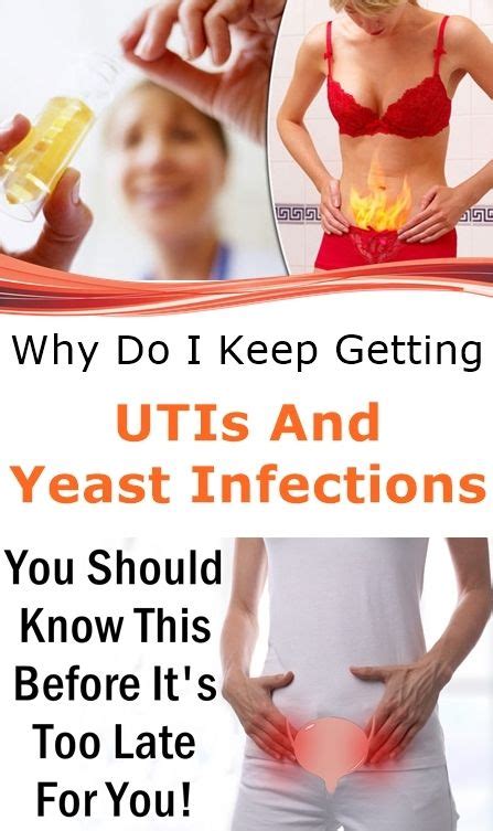 every woman must know this yeast infection yeast infection relief candida yeast infection