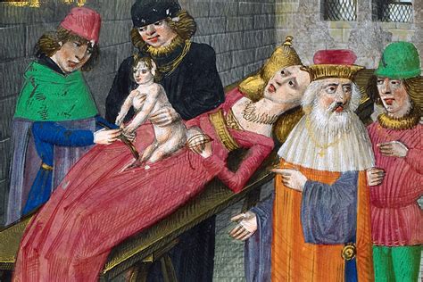 How Medieval Surgeons Shaped Sex And Gender Flipboard