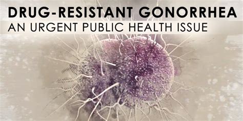 Drug Resistant Gonorrhea An Urgent Public Health Issue National