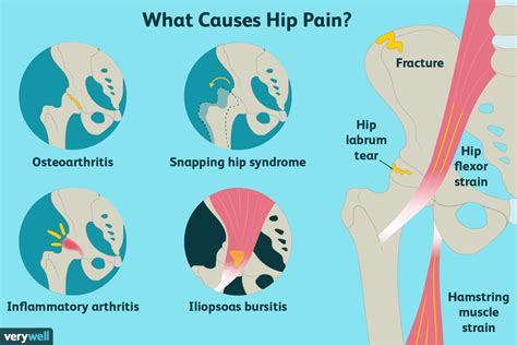 hip pain  treatment      healthcare provider