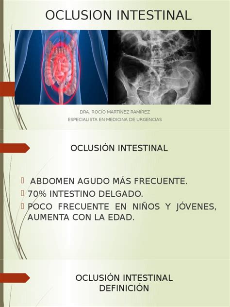 oclusion intestinal