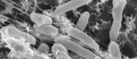 hallan una bacteria   el plastico revista el federal