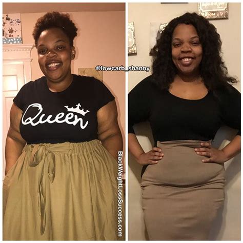 Pin On Before And After Weight Loss Stories