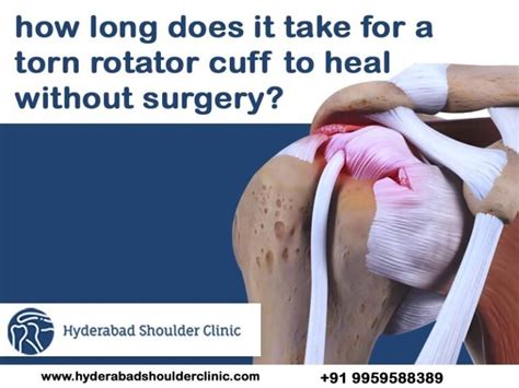 how long does it take for a torn rotator cuff to heal without surgery