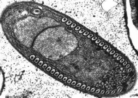 Microsporidia Wikipedia La Enciclopedia Libre Hongos La