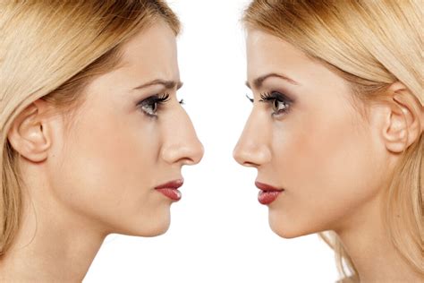 perfect nose shape  guide emlii