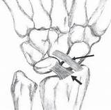 Wrist Ligaments Long Hand Orthobullets Biomechanics Rsc sketch template