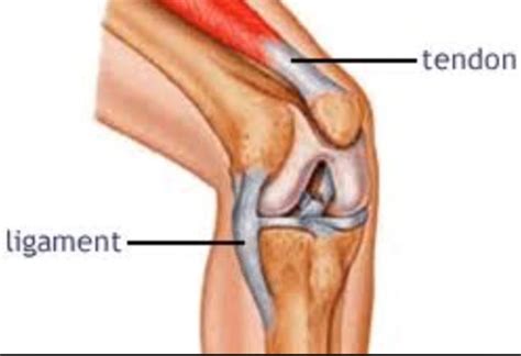 ligament injuries   acl tears occur  direct contact