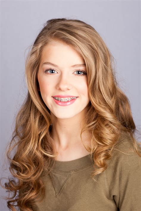 braces after photo gallery spark orthodontics