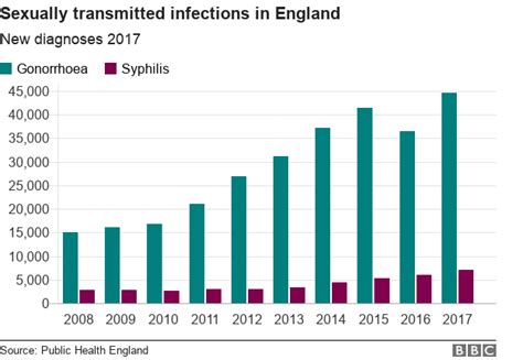 syphilis and gonorrhoea up by one fifth sri lanka