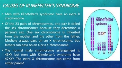 10 Images About Klinefelters Syndrome On Pinterest Mast Cell