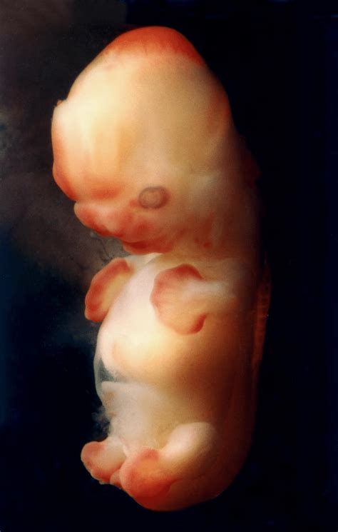 weeks   days pregnant baby fetal progress