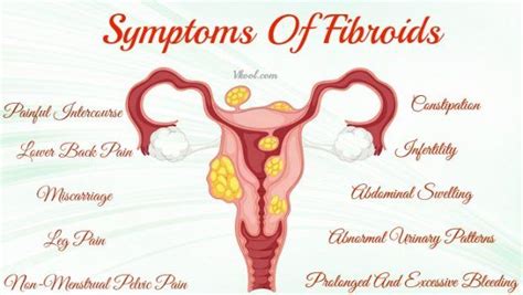 10 Early Signs And Symptoms Of Fibroids In Uterus