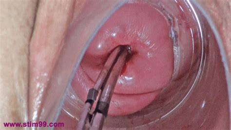 cervix insertion cock pics and galleries