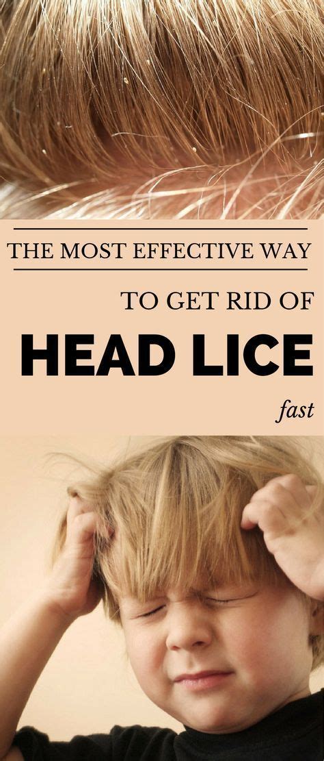 the most effective way to get rid of head lice fast head louse louse