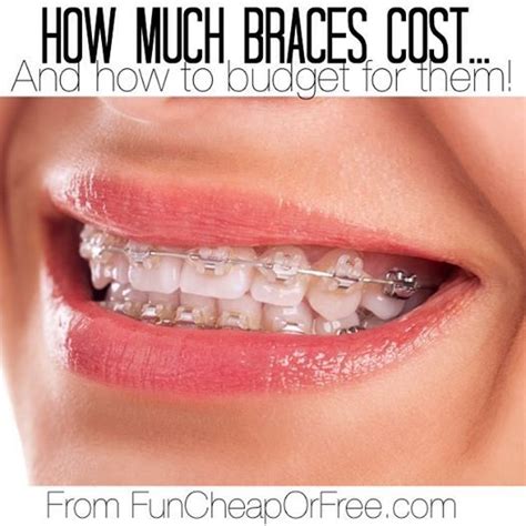 invisalign cost vs braces cost how to budget fun cheap or free