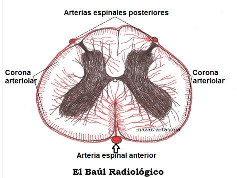 el baul radiologico edema de la medula espinal hallazgos en irm