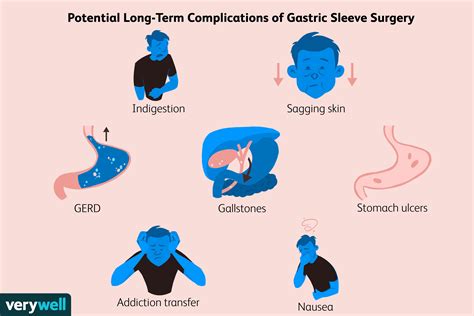 Long Term Complications After Gastric Sleeve Surgery