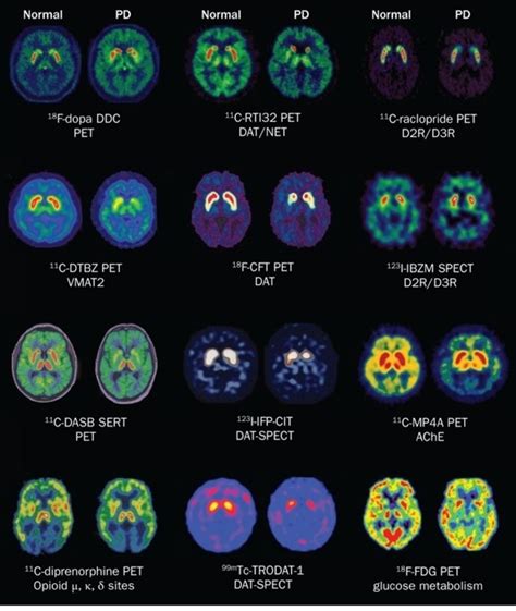 Are These Brain Scan Images Real See Source Do They Support The Idea