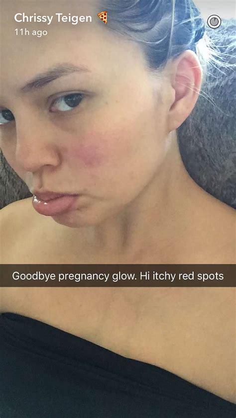 chrissy teigen s no makeup selfie shows what happens to skin after