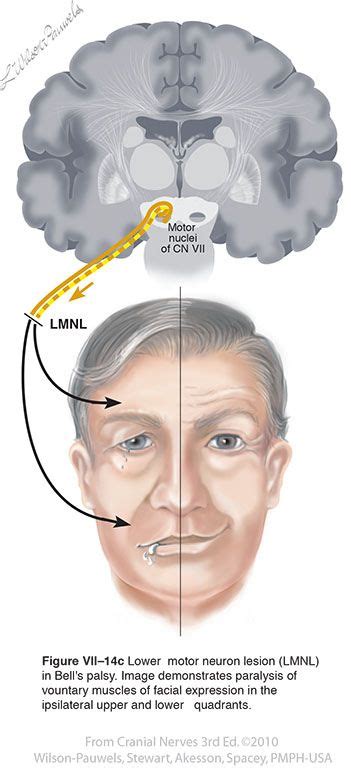 facial vii cranial nerves