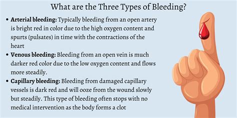 types  bleeding  aid