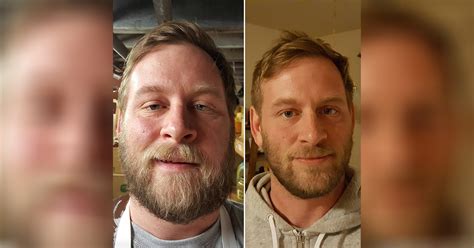 14 Remarkable Before And After Photos Of People Who Quit Drinking