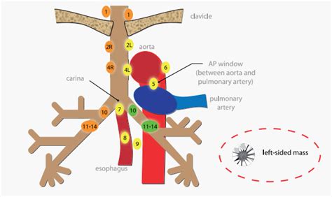 Mediastinal Lymph Node Stations Diagram Quizlet