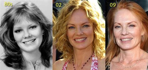 Marg Helgenberger Botox Lip Injectionsnew Celebrity