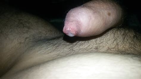 Tight Foreskin Dripping Cum Phimosis 3 Pics Xhamster