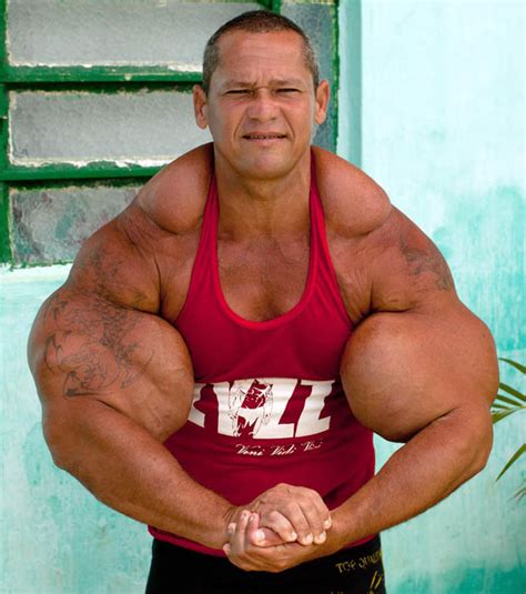 Muscle Addict Arlindo De Souza Injects Oil And Alcohol Into His Arms To