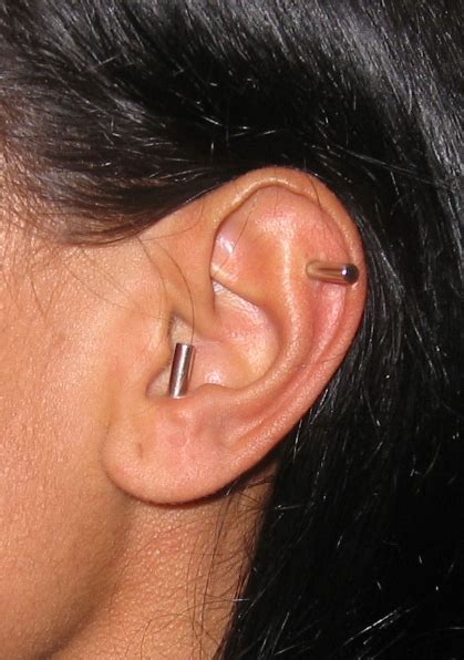 ear acu magnets boca raton acupuncture chinese medicine