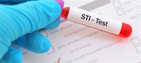 stis and stds all you need to know bay college lockwood clinic