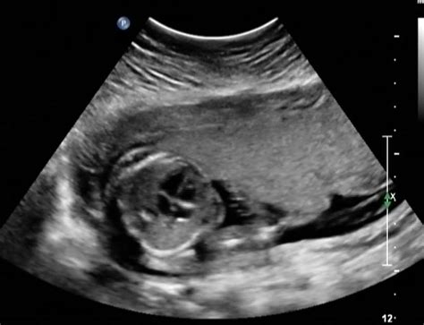 fetal ultrasound image gallery imaging technology news