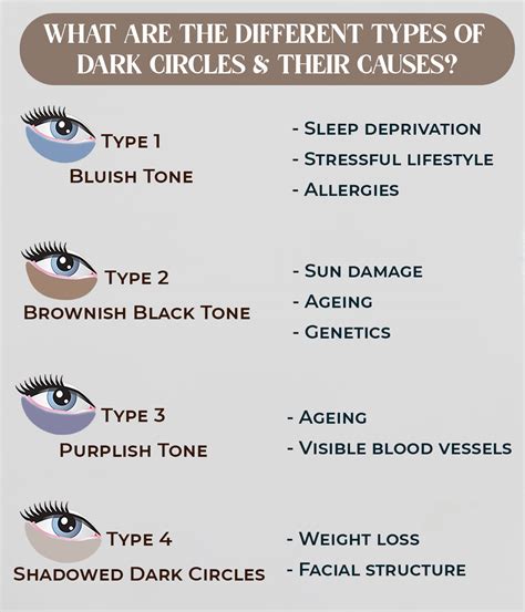 shades  dark circles    manage
