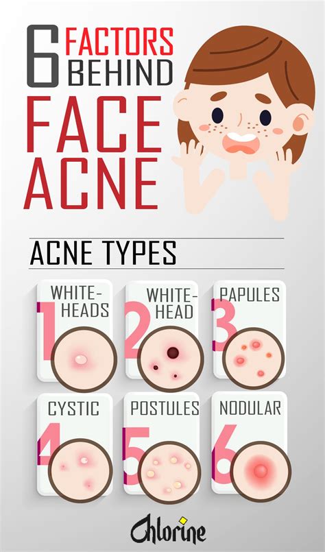 what causes acne 6 factors behind skin acne and pimples in 2021 acne