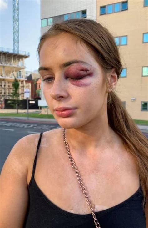 Teen Girl Assaulted After Telling Men She Wasnt Interested In Sex