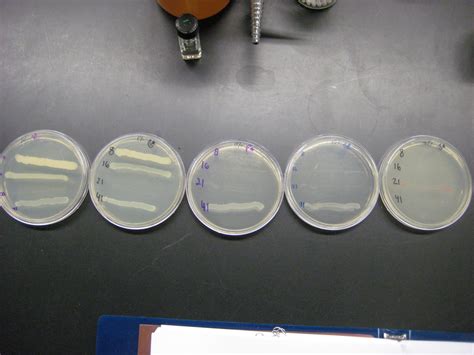 Dvc Microbiology 146 Fall 11 Gard Lab 9 Effect Of Osmotic Pressure