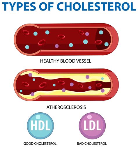 foods     ldl bad cholesterol levels naturally novi health