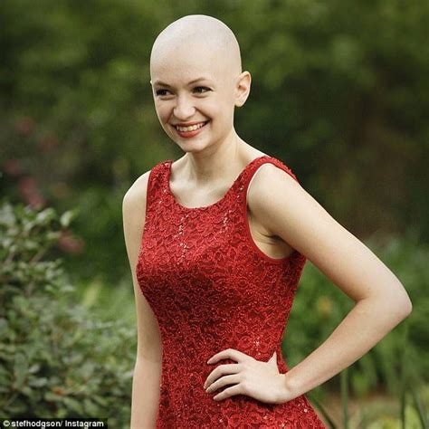 Woman Living With Alopecia Opens Up About Her Tortuous Hair Loss