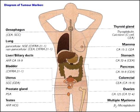 Tumour Markers Edit  1128×902 Медицинский Здоровье Природа