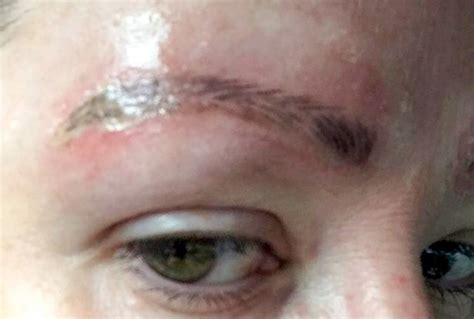 woman shares pictures   eyebrows  botched