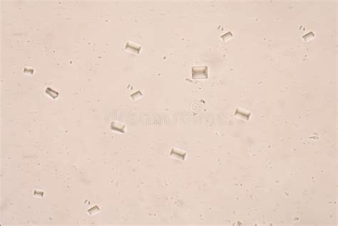 triple phosphate crystals  human urine stock photo image
