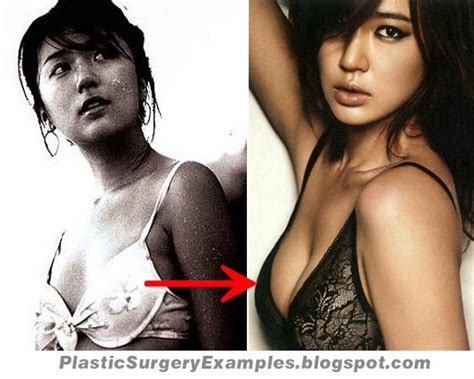 Plastic Surgery Examples December 2013