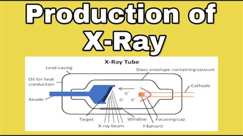 production   rays radiology buzz youtube