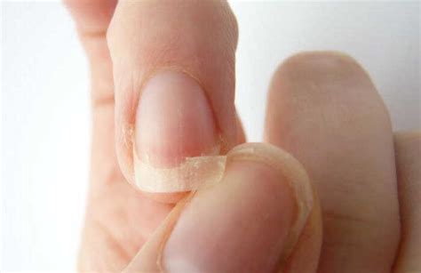 20 simple home remedies for strengthening weak nails