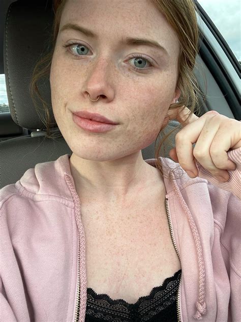 no makeup just means more freckle exposure 🍓 r freckledgirls