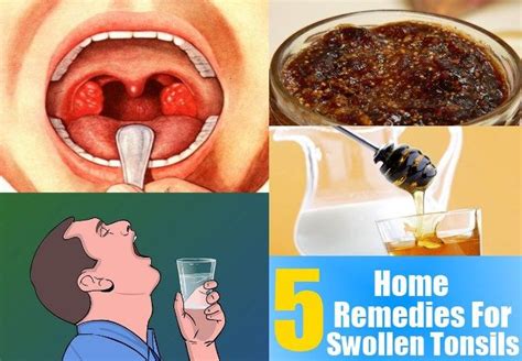 enlarged tonsils and behavior problems sore frequently