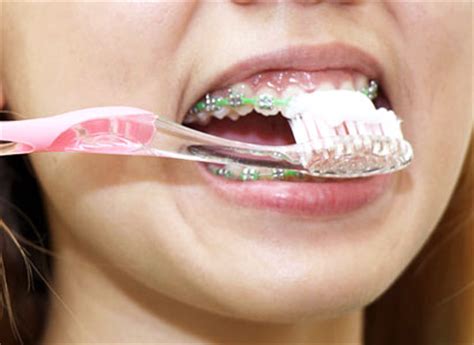 clean  braces mississauga dentist dental office