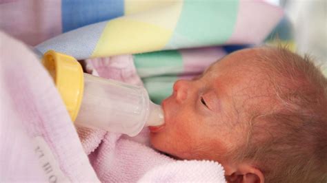 specialneeds feeder baby  cleft palate hospital  medela